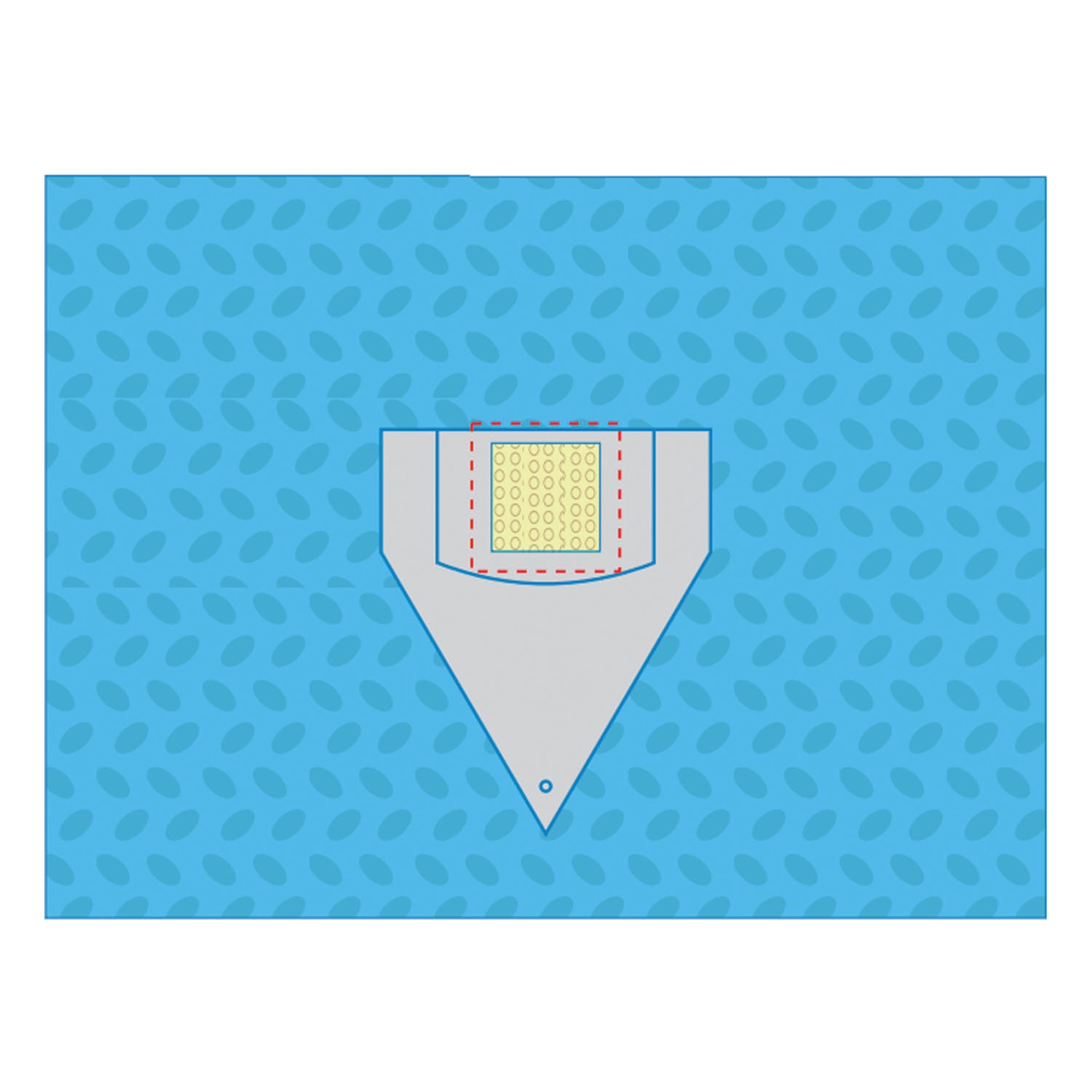 SUBMED Percutan (Nephrology) Drape